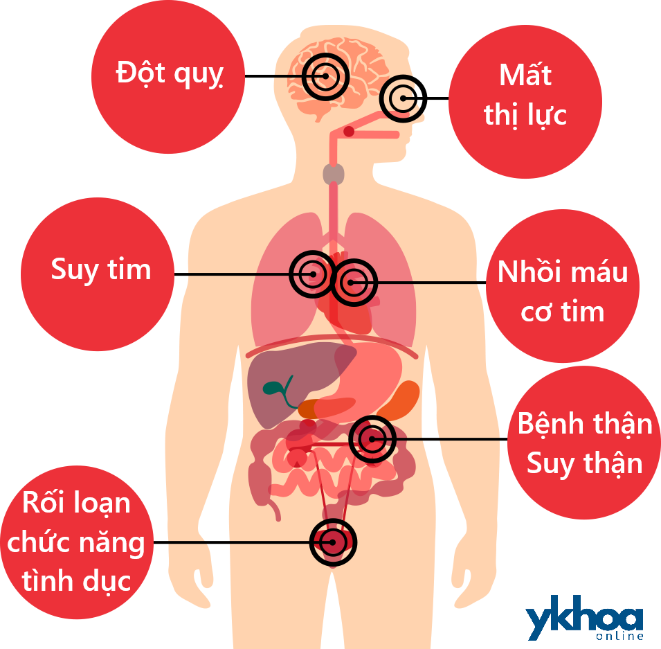 Biến chứng của tăng huyết áp